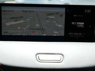 2025 Acura TLX with A-Spec Package