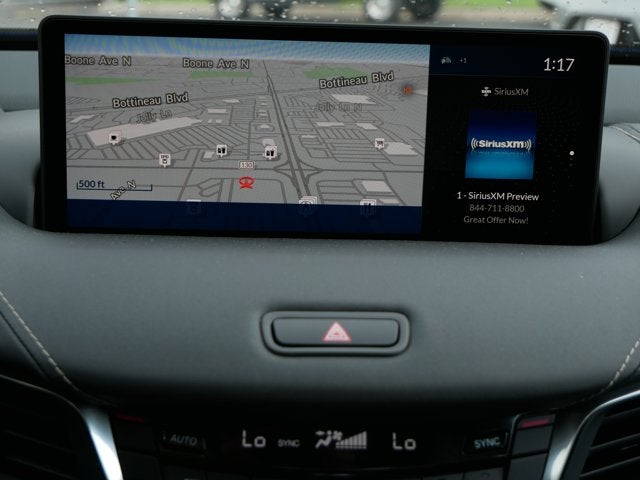 2025 Acura TLX with A-Spec Package